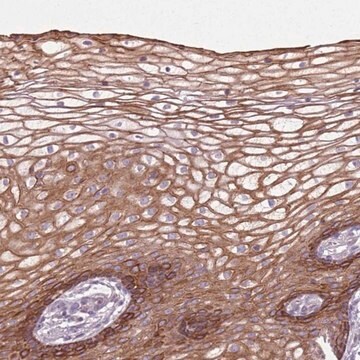 Anti-HSPA14 antibody produced in rabbit Prestige Antibodies&#174; Powered by Atlas Antibodies, affinity isolated antibody, buffered aqueous glycerol solution