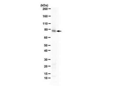 Anti-RecQ1 from rabbit