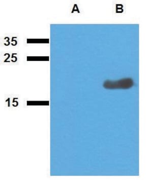 Anti-Acr2 (M. tuberculosis) antibody produced in rabbit