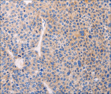 Anti-ADCY1 antibody produced in rabbit affinity isolated antibody