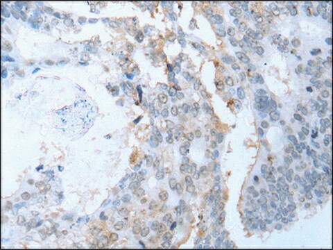 Anti-SYCP2 affinity isolated antibody