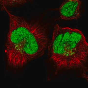 Anti-ANKRD49 antibody produced in rabbit Prestige Antibodies&#174; Powered by Atlas Antibodies, affinity isolated antibody