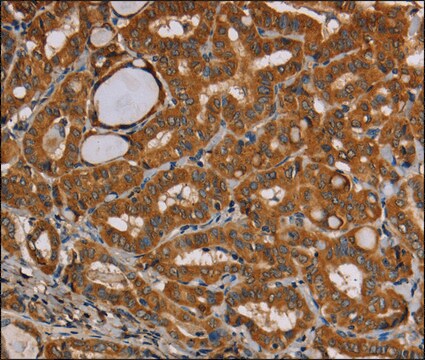 Anti-CENPU antibody produced in rabbit affinity isolated antibody