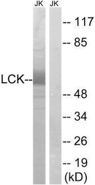 Anti-LCK antibody produced in rabbit affinity isolated antibody