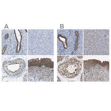 Anti-TES antibody produced in rabbit Prestige Antibodies&#174; Powered by Atlas Antibodies, affinity isolated antibody, buffered aqueous glycerol solution