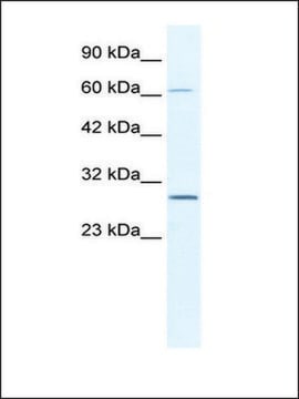 Anti-PARP11 antibody produced in rabbit affinity isolated antibody