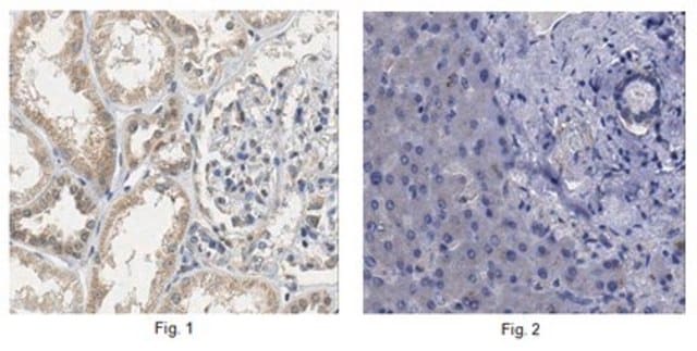 Anti-LARS Antibody from rabbit, purified by affinity chromatography