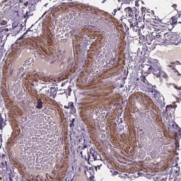 Anti-CLN3 antibody produced in rabbit Prestige Antibodies&#174; Powered by Atlas Antibodies, affinity isolated antibody, buffered aqueous glycerol solution