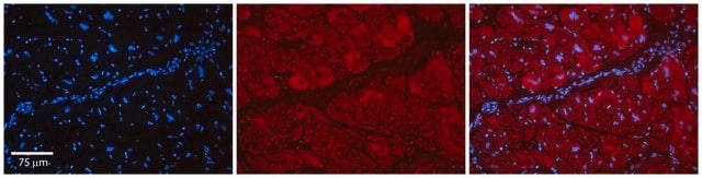 Anti-PARP16 antibody produced in rabbit affinity isolated antibody