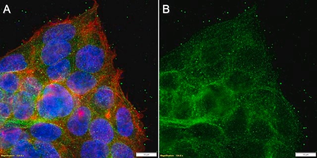 Anti-ApoE Antibody, clone 3N14 ZooMAb&#174; Rabbit Monoclonal recombinant, expressed in HEK 293 cells