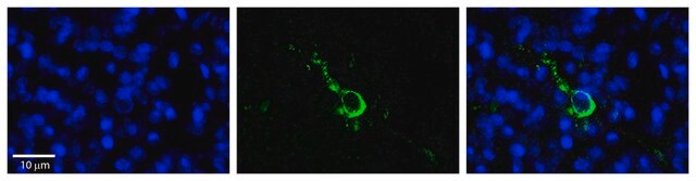 Anti-LPIN1 antibody produced in rabbit affinity isolated antibody