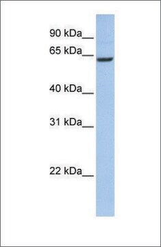 Anti-CCDC67 antibody produced in rabbit affinity isolated antibody