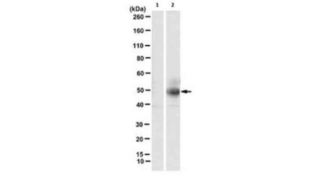 Anti-phospho-cytokeratin-18 (K18) (Ser33) Antibody, clone IB4 clone IB4, from mouse