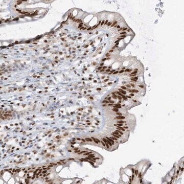 Anti-SAMD15 antibody produced in rabbit Prestige Antibodies&#174; Powered by Atlas Antibodies, affinity isolated antibody, buffered aqueous glycerol solution, ab2