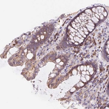 Anti-TMEM71 antibody produced in rabbit Prestige Antibodies&#174; Powered by Atlas Antibodies, affinity isolated antibody, buffered aqueous glycerol solution