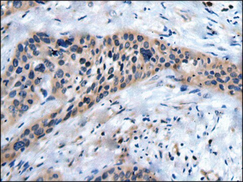 Anti-SLC17A8 affinity isolated antibody