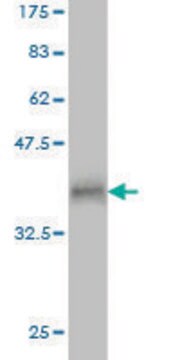 Monoclonal Anti-RNF17 antibody produced in mouse clone 1E3, purified immunoglobulin, buffered aqueous solution