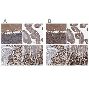 Anti-SUCLG1 antibody produced in rabbit Prestige Antibodies&#174; Powered by Atlas Antibodies, affinity isolated antibody, buffered aqueous glycerol solution