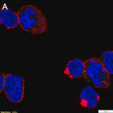 Anti-p-ZAP-70 (Tyr493) Antibody, clone 1F10 ZooMAb&#174; Rabbit Monoclonal recombinant, expressed in HEK 293 cells