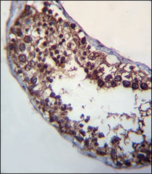 ANTI-POMT1 (C-TERM) antibody produced in rabbit IgG fraction of antiserum, buffered aqueous solution