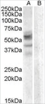 抗アリルスルファターゼD抗体 ヤギ宿主抗体 affinity isolated antibody, buffered aqueous solution