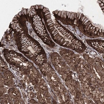 Anti-Card6 Antibody Produced In Rabbit Prestige Antibodies&#174; Powered by Atlas Antibodies, affinity isolated antibody, buffered aqueous glycerol solution