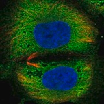 Anti-TSBP1 antibody produced in rabbit Prestige Antibodies&#174; Powered by Atlas Antibodies, affinity isolated antibody, buffered aqueous glycerol solution