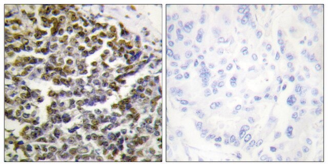 Anti-TCOF1, N-Terminal antibody produced in rabbit affinity isolated antibody