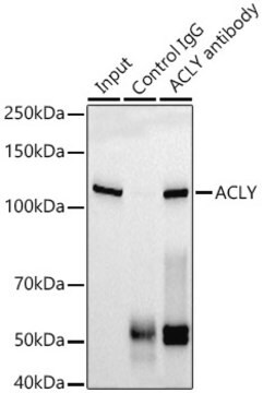 Anti-ACLY Antibody, clone 8A0V0, Rabbit Monoclonal