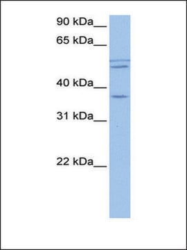 Anti-CCDC78 antibody produced in rabbit affinity isolated antibody