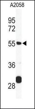 Anti-TPIPb (C-term) antibody produced in rabbit IgG fraction of antiserum, buffered aqueous solution