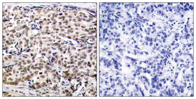 Anti-CREB antibody produced in rabbit affinity isolated antibody