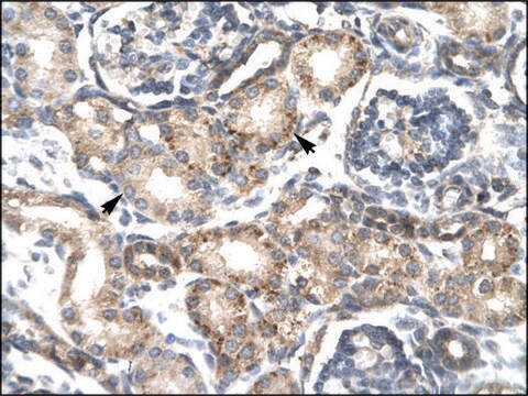 Anti-RGS20 (AB1) antibody produced in rabbit IgG fraction of antiserum