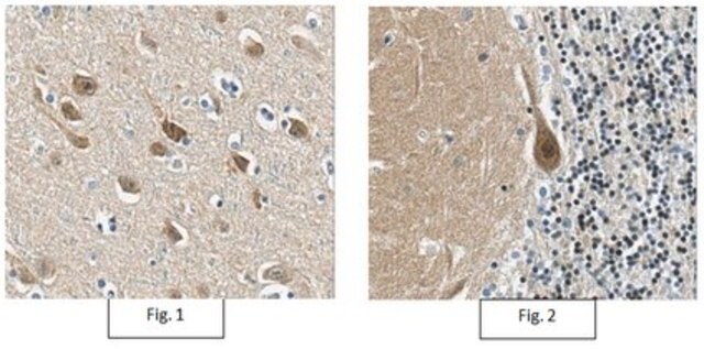 Anti-CRTC1 Antibody/TORC-1, clone 5F3.1 clone 5F3.1, from mouse