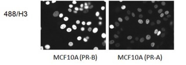 Anti-Progesterone Receptor A/B Antibody, clone 488/H3 clone 488/H3, from mouse