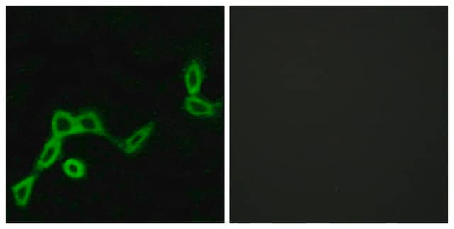 Anti-KISS1R antibody produced in rabbit affinity isolated antibody