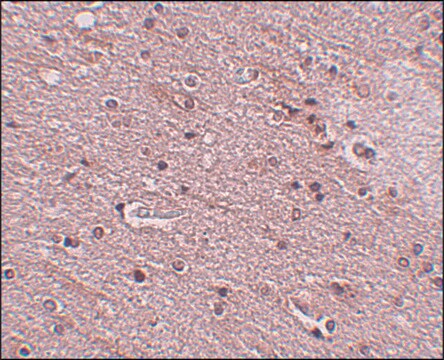 Anti-TMEM16B antibody produced in rabbit affinity isolated antibody, buffered aqueous solution