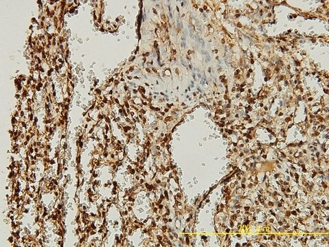 Monoclonal Anti-ORC2L antibody produced in mouse clone 3E11-1G5, purified immunoglobulin, buffered aqueous solution