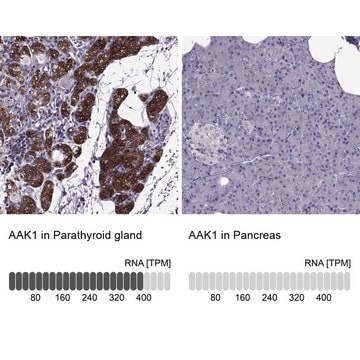 Anti-AAK1 antibody produced in rabbit Prestige Antibodies&#174; Powered by Atlas Antibodies, affinity isolated antibody, buffered aqueous glycerol solution