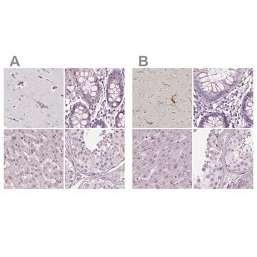 Anti-PNOC antibody produced in rabbit Prestige Antibodies&#174; Powered by Atlas Antibodies, affinity isolated antibody, buffered aqueous glycerol solution