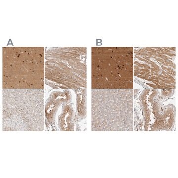 Anti-TOM1L2 antibody produced in rabbit Prestige Antibodies&#174; Powered by Atlas Antibodies, affinity isolated antibody, buffered aqueous glycerol solution, Ab1