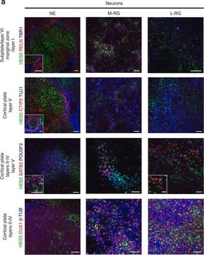 Anticuerpo anti-reelina, a.a. 164-496 de mreelina, clon G10 clone G10, Chemicon&#174;, from mouse