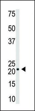 ANTI-VILIP1(C-TERMINAL) antibody produced in rabbit IgG fraction of antiserum, buffered aqueous solution