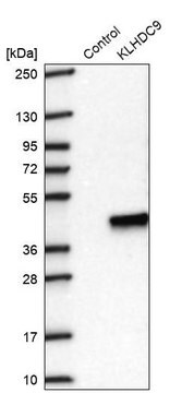 Anti-KLHDC9 antibody produced in rabbit Prestige Antibodies&#174; Powered by Atlas Antibodies, affinity isolated antibody, buffered aqueous glycerol solution