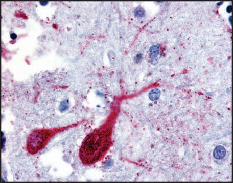 Anti-SLC5A9 (AB3) antibody produced in rabbit affinity isolated antibody, buffered aqueous solution