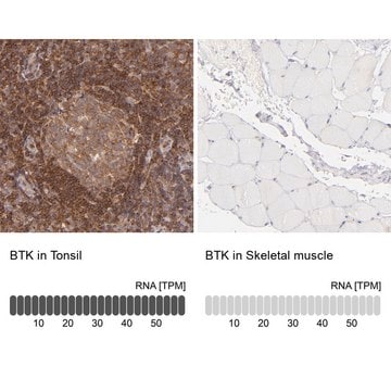 Anti-BTK antibody produced in rabbit Ab2, Prestige Antibodies&#174; Powered by Atlas Antibodies, affinity isolated antibody, buffered aqueous glycerol solution