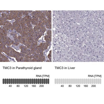 Anti-TMC3 antibody produced in rabbit Prestige Antibodies&#174; Powered by Atlas Antibodies, affinity isolated antibody, buffered aqueous glycerol solution