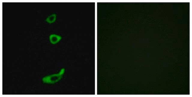 Anti-CRHR1 antibody produced in rabbit affinity isolated antibody