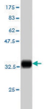 Monoclonal Anti-S100A6, (C-terminal) antibody produced in mouse clone 6D1, purified immunoglobulin, buffered aqueous solution