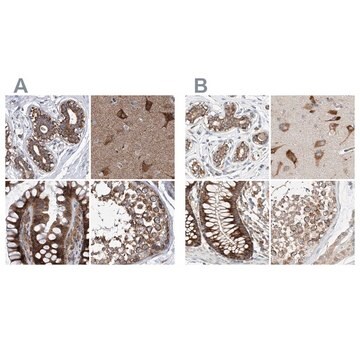 Anti-ZC3H15 antibody produced in rabbit Prestige Antibodies&#174; Powered by Atlas Antibodies, affinity isolated antibody, buffered aqueous glycerol solution, ab1